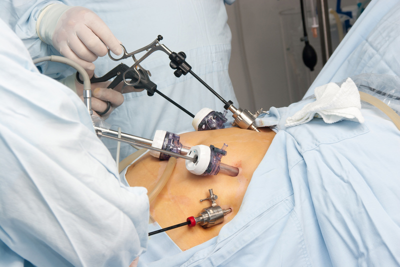 Portrait of gastric bypass surgery in hospital