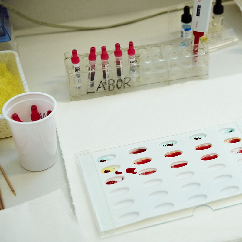 Das Labor steht täglich für die Versorgung von Krankenhauspatientinnen und Krankenhauspatienten zur Verfügung