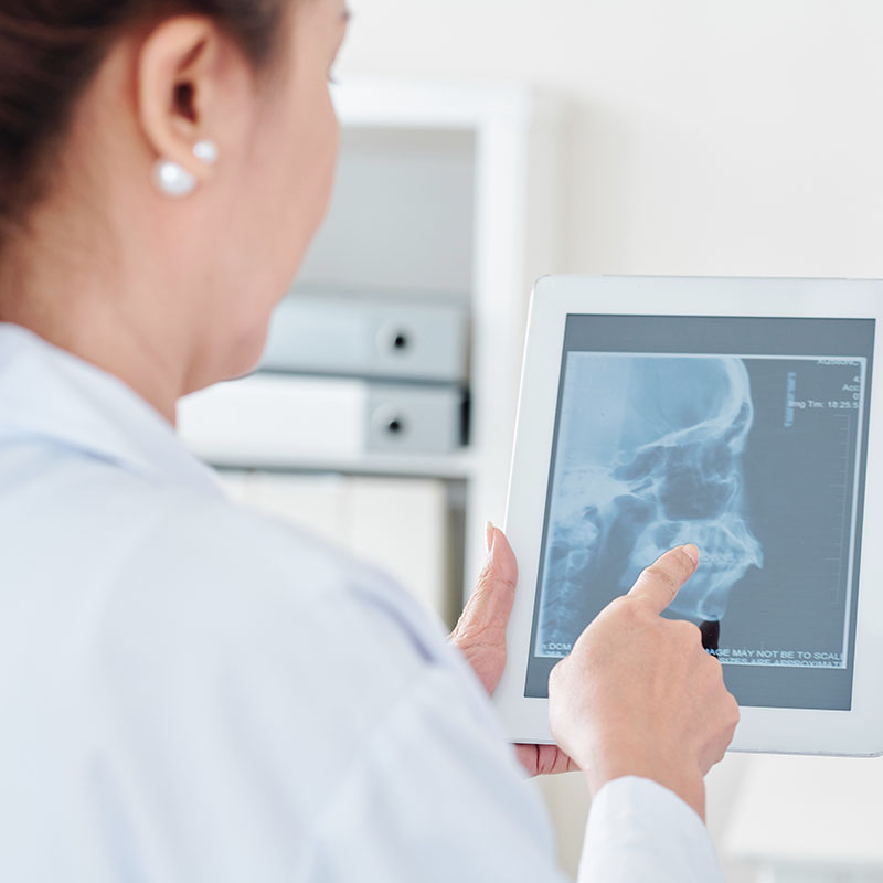 Neurologist and radiologist discussing scull x-ray of patient on tablet computer in medical office