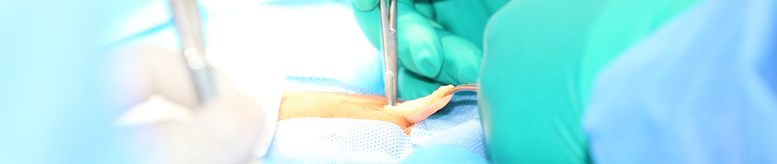 Open hernia surgery