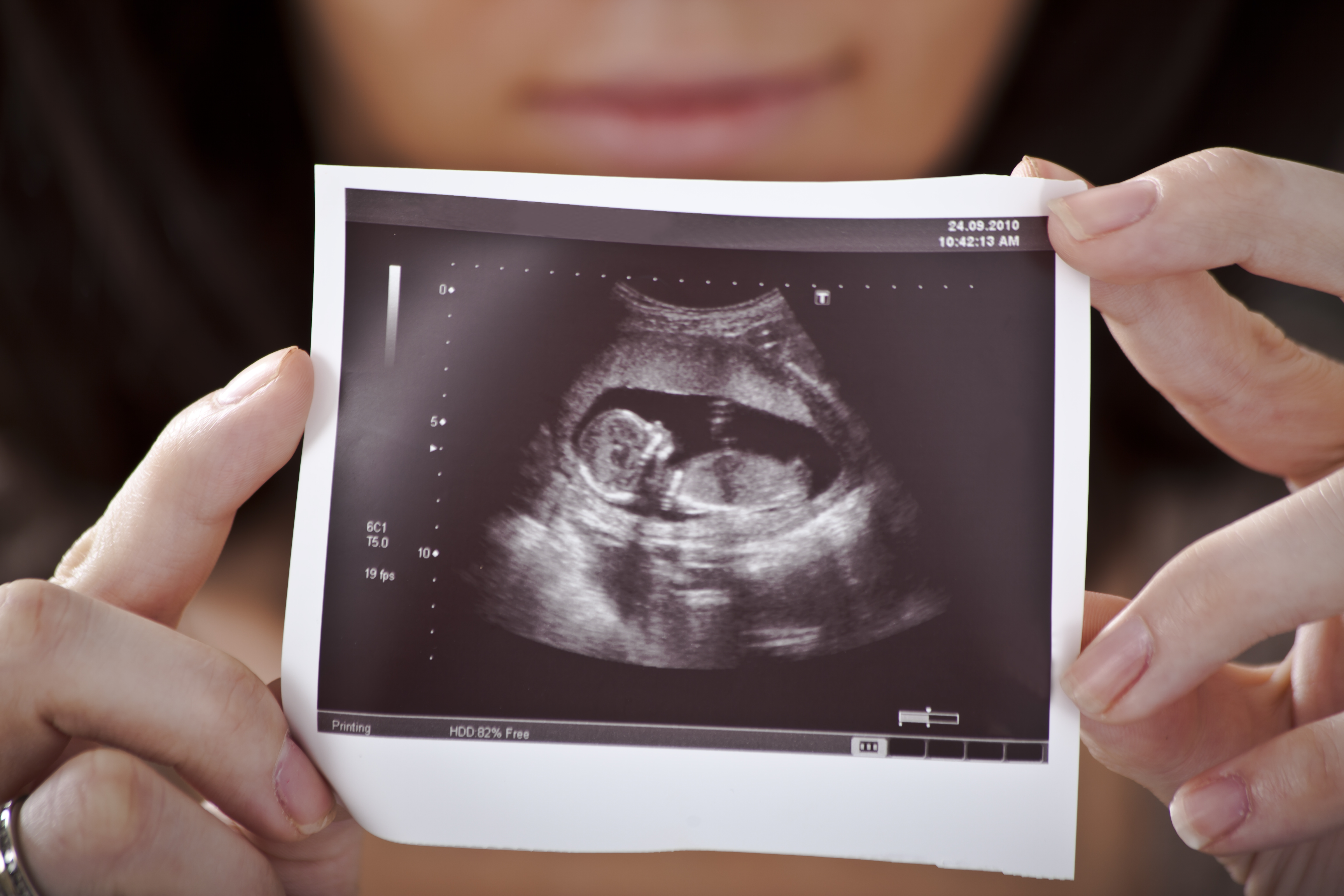 Woman holding ultrasound picture of her baby