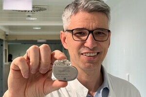 Prim. Priv.-Doz. Dr. Riss, FRCS mit einem Darmschrittmacher in der Hand. 